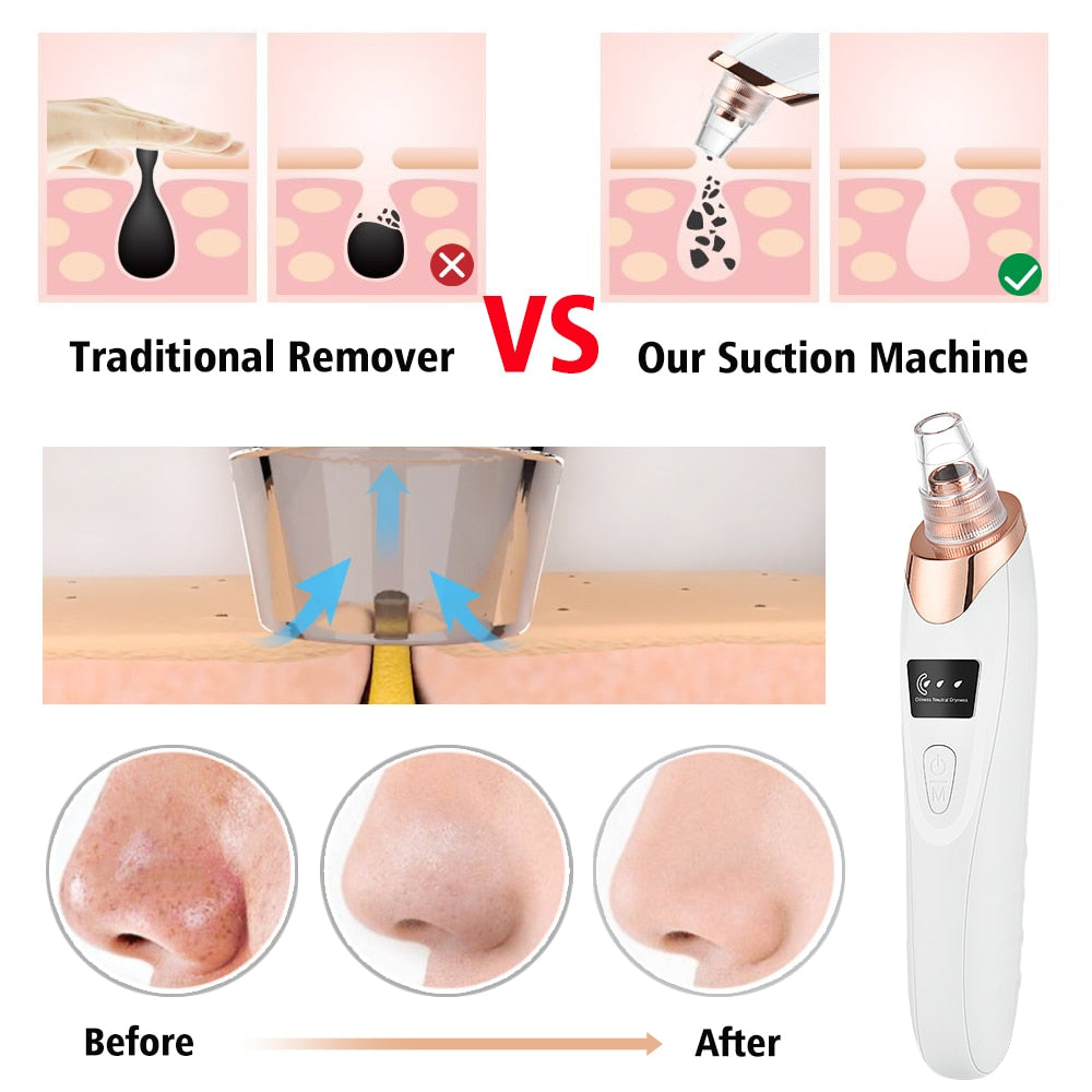 Electric Blackhead Remover Vacuum Acne Cleaner Black Spots Removal Facial Deep Cleansing Pore Cleaner Machine Skin Care Tools