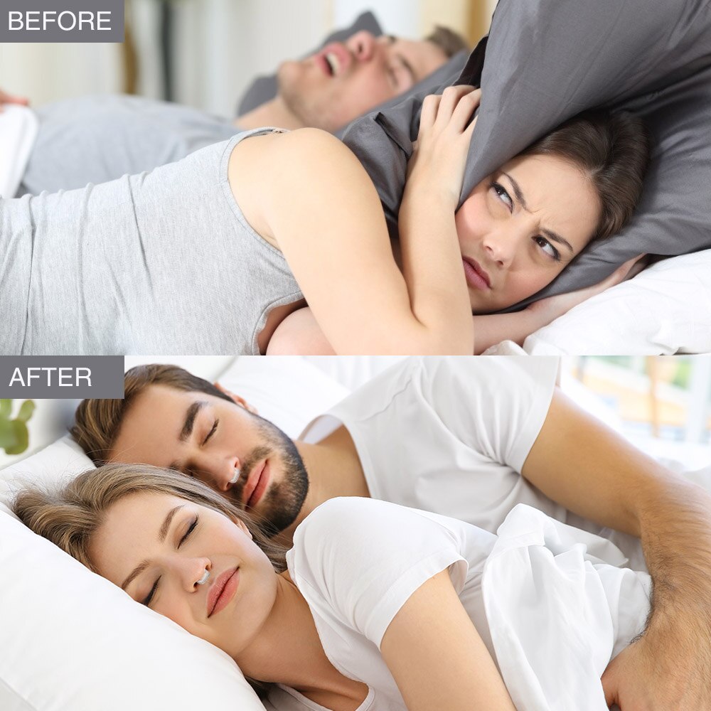 4pcs/set Silicone Magnetic Anti Snore Stop Snoring Nose Clip Sleep Tray Sleeping Aid Apnea Guard Night Device Health Care